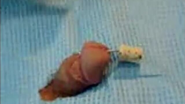 Прокол члена