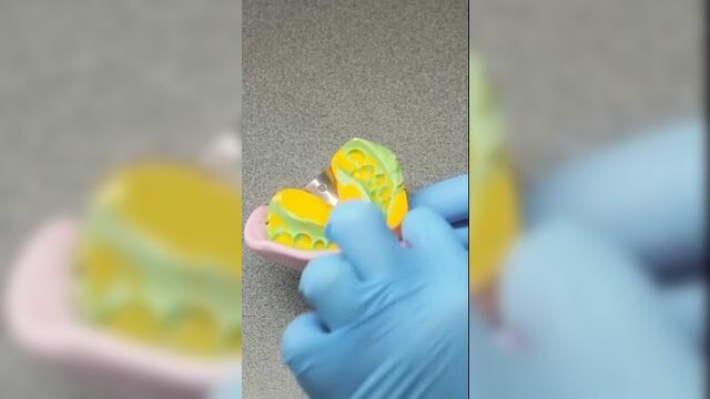 Грилзы – модное украшение для зубов