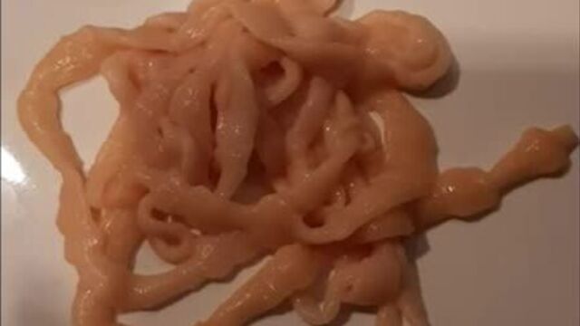 Ленточный червь (cestoda) из кишечника человека