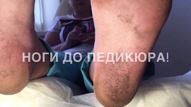 Golden trace-линия препаратов для педикюра 