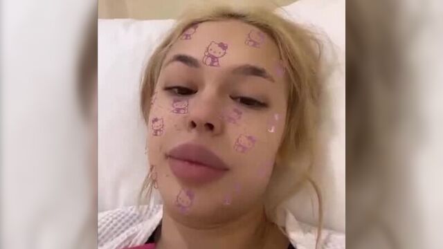 Инстасамка показала себя после пластики