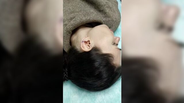 Процесс прокола форвард хеликс