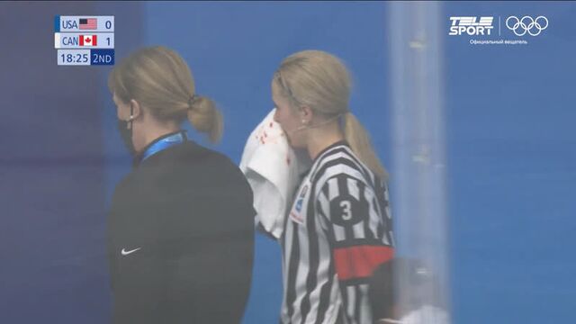 Женский хоккей. олимпиада-2022. судья пострадала.