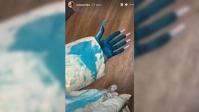 Инстасамку облили зелёнкой