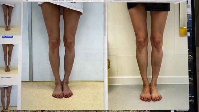 Video by пластический хирург александр соколов