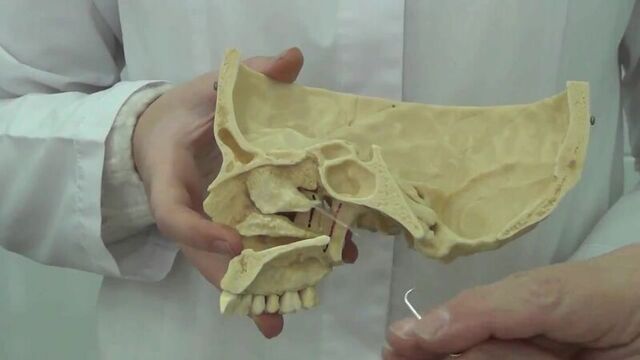 Крыловидно-нёбная ямка (fossa pterygopalatina)