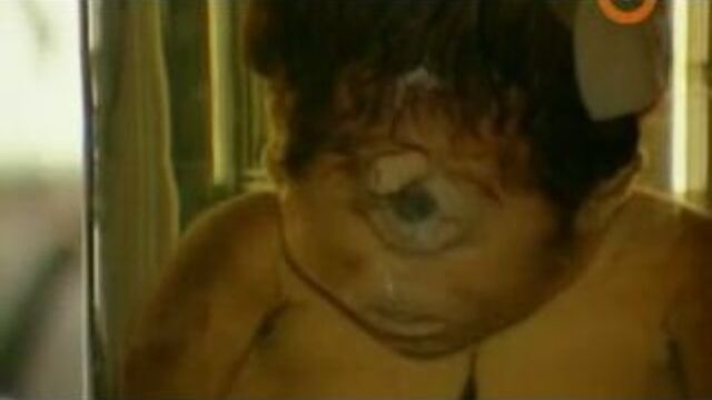 №150 - мутации - редкие заболевания _/- люди мутанты